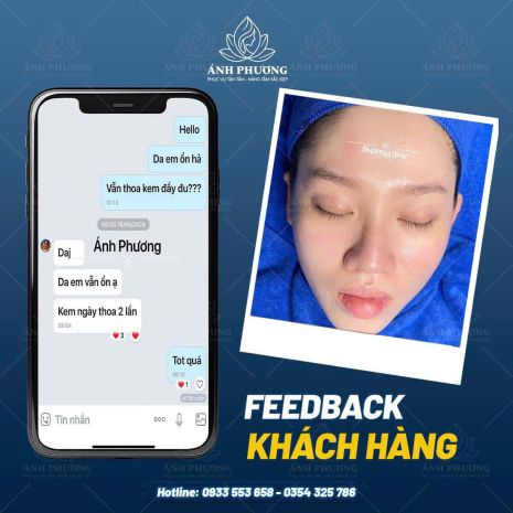 Chỉ 999k  liệu trình xoá nám công nghệ cao trong 30 ngày 6857362